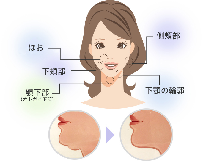 アプローチできる部位01