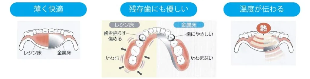 金属床義歯の特徴