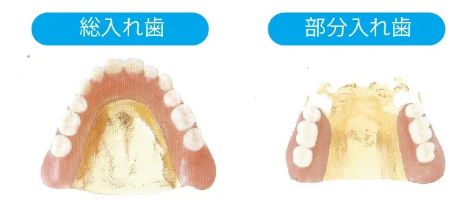 ゴールド床