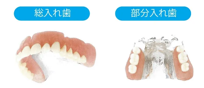 チタン床